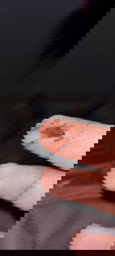 Flek coklat tua usia janin 11 minggu