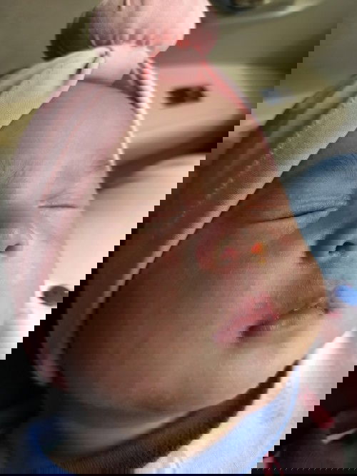 Sharing cara perawatan kulit bayi sensitif