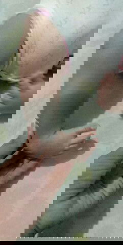 HELP MY CLUBFOOT BABY😭🙏