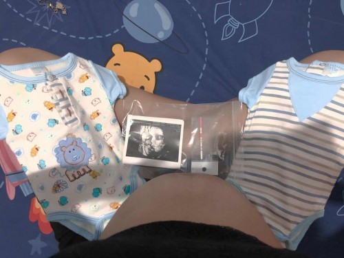 ทีมกรกฎาคม ตื่นเต้นกันมั้ยค่ะ
คิดว่าผ่าหรือคลอดธรรมชาติดี