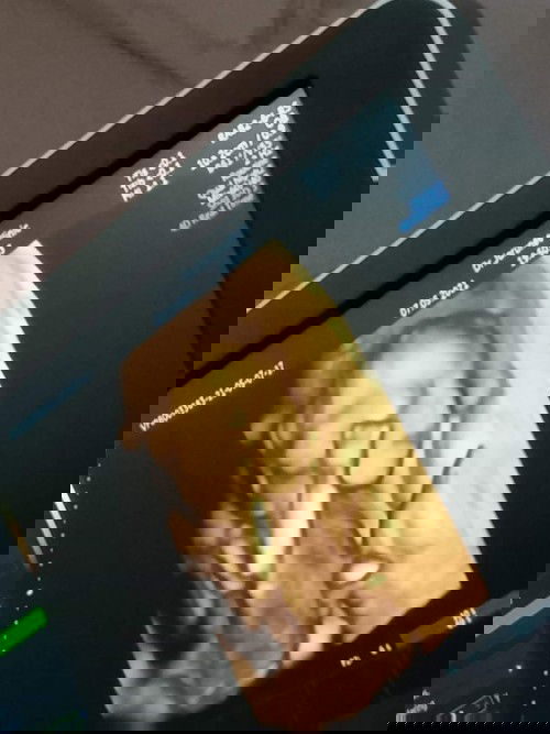 ขอดูภาพซาวด์น้องตอน5เดือน