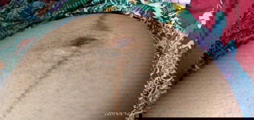 หน้าท้องตรงสะดือบุ๋ม