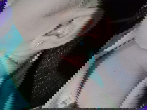 Bun mau tanya sih ini kenapa yah dilipetan lehernya, apa biang keringet trus dksh apa ya