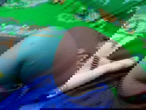 Gigitan nyamuk dan lotion/krim anti nyamuk