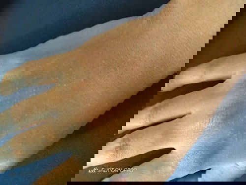 ข้อคำแนะนำหน่อยค่ะ