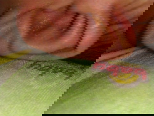 Telinga berair dan bintik-bintik merah