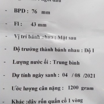 Thai nhi 27 tuân .. mom xem hộ dùm mình ...dây rốn quấn cổ 1 vòng có ảnh hưởng gì không