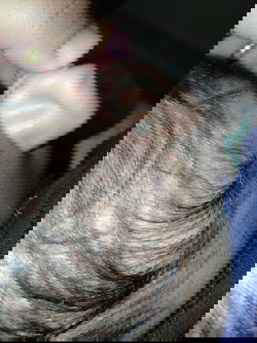 Benjolan di belakang telinga