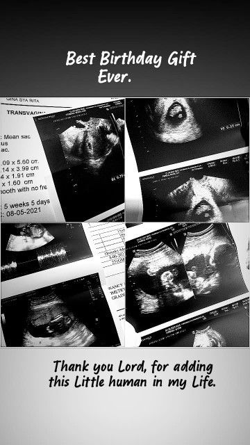 IT'S A GIRL. ❤❤❤