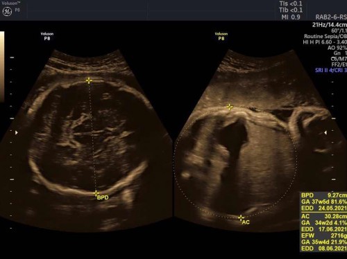 Berapa lama pembukaan 1 ke 10