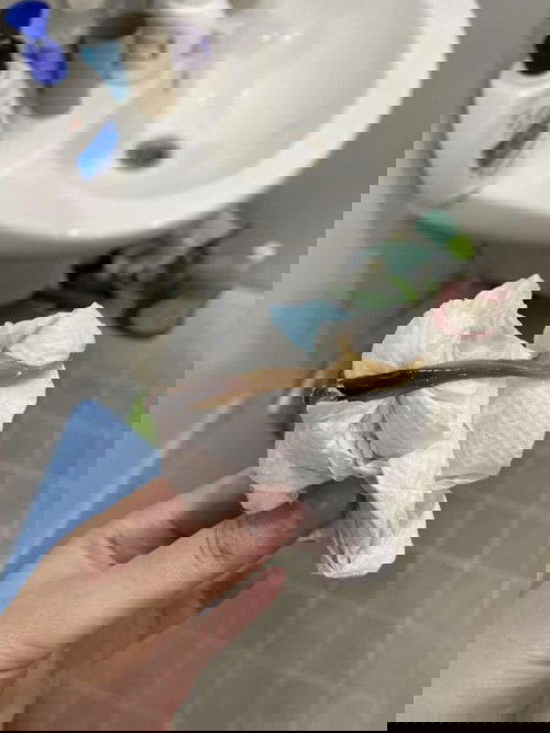 ปลายรกชิดมดลูก