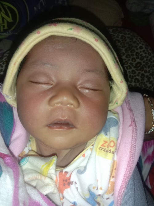 Bayi kuning