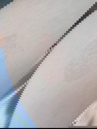 ano po pwd na gamot para dito.