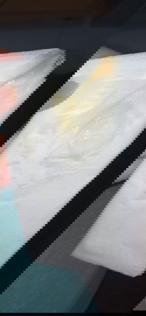 Menjelang persalinan