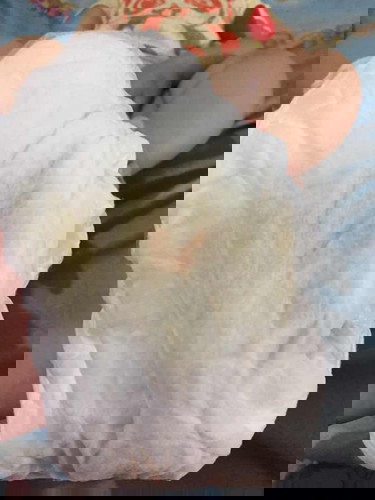 Bercak kemerahan pada popok bayi