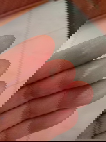 กำหนดคลอด15พ.ค ค่ะ