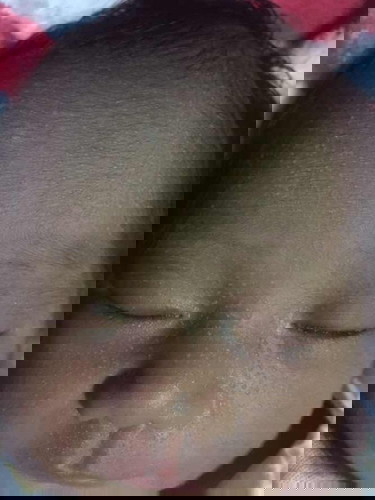 น้องเป็นอะไรคะ ใครรู้บอกหน่อยคะขึ้นจุดแบบนี้เต็มหน้าเลย🥺