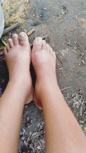 อายุครรภ์ 35+5