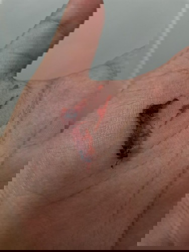 Miscarriage na po kaya ito?