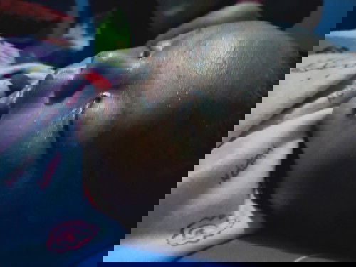 Wajah bayi bruntusan