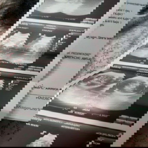 BABY GIRL NAME SUGGESTIONS 💖