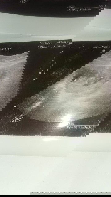 UK 11w2d Alhamdulillah sehat,d UK 7w sempet ada flek