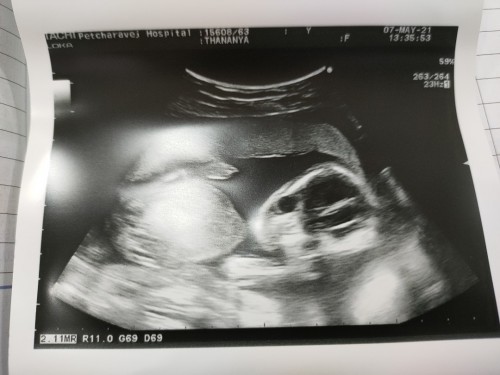 กลัวลูกตัวเล็ก