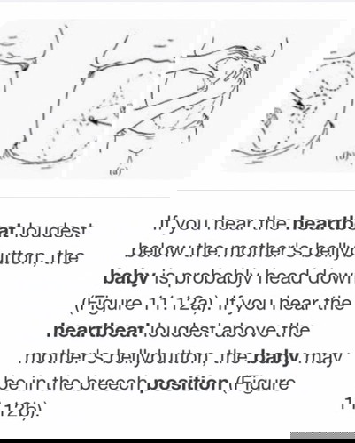 Pregnant between 37-38 weeks