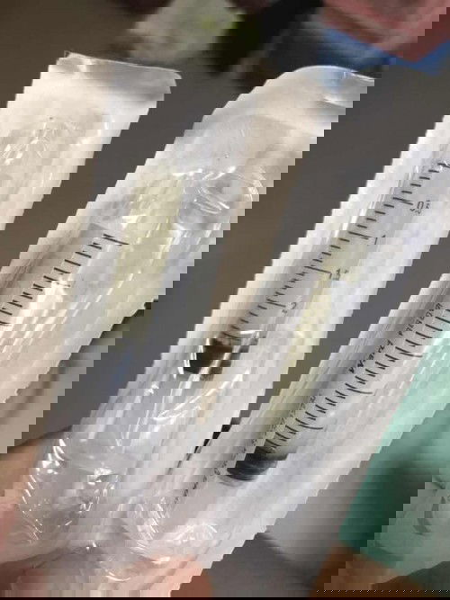 ปั๋มนมใส่ถุงเดียวกันได้มั้ย