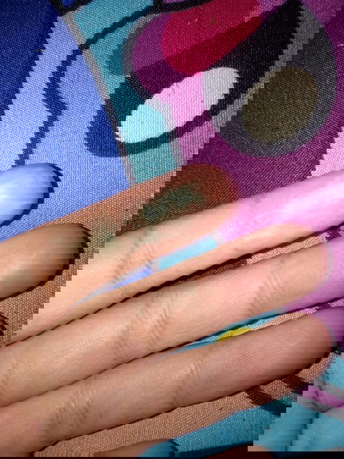 ตกขาวแบบนี้ปกติไหมคะ