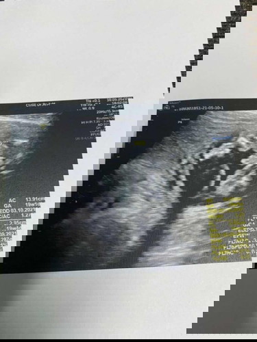 ลูกชายของแม่🥰