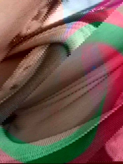 Berbagi pengalaman biang keringat