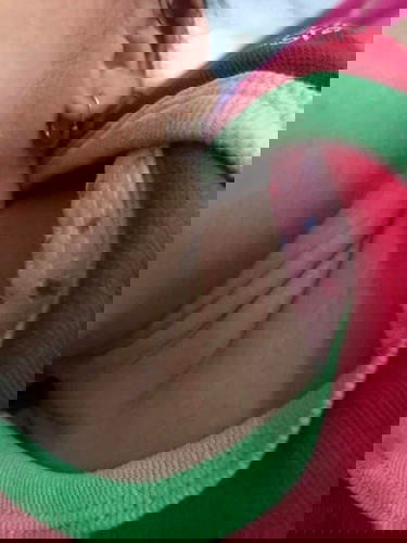 Berbagi pengalaman biang keringat