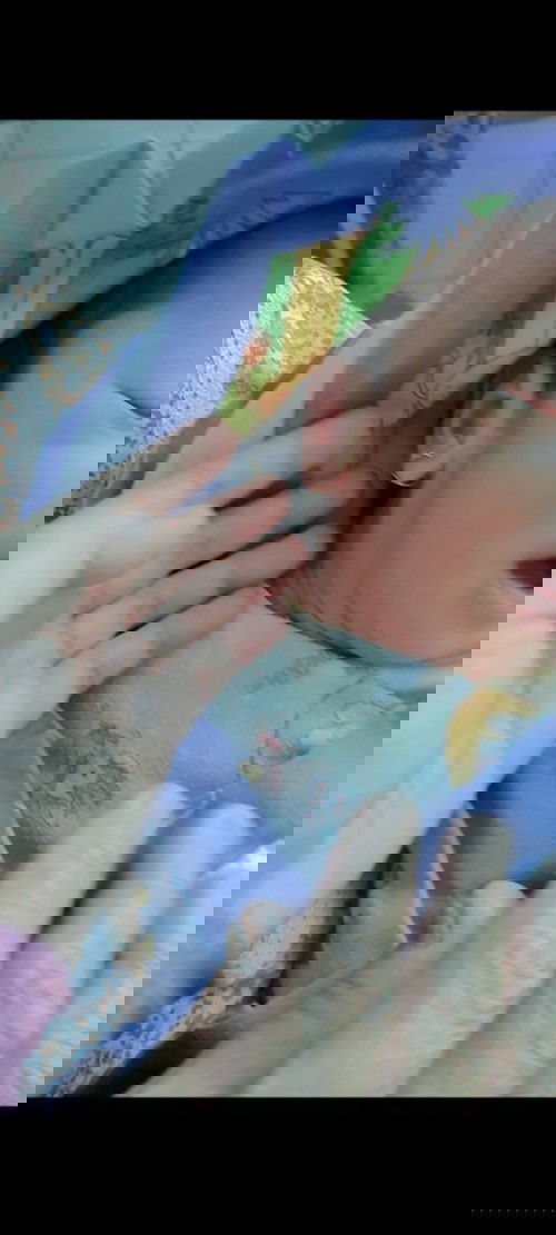 Sunat & pasang anting