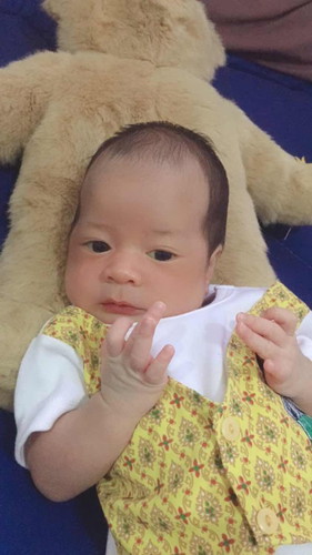 ลูก1เดือนแล้วแต่ตาเหลือง
