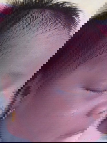 Bé nổi mấy mục như này trên mặt và trán.có sao không vậy mấy mom