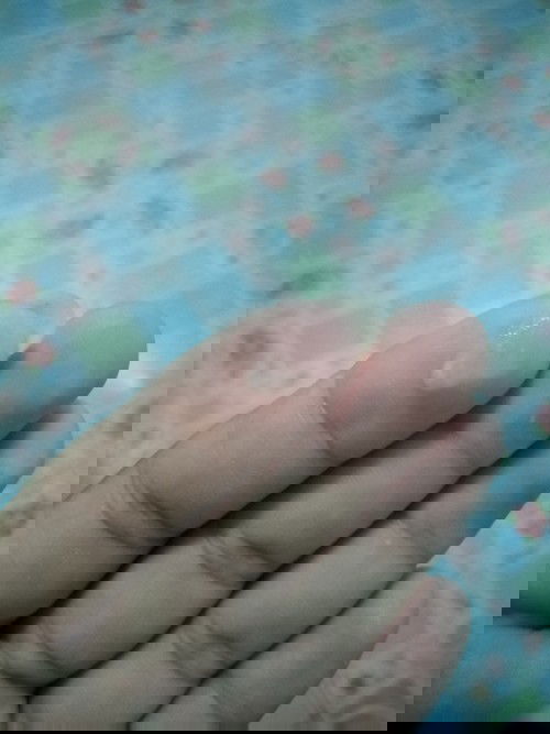 37สัปดาห์​4วัน