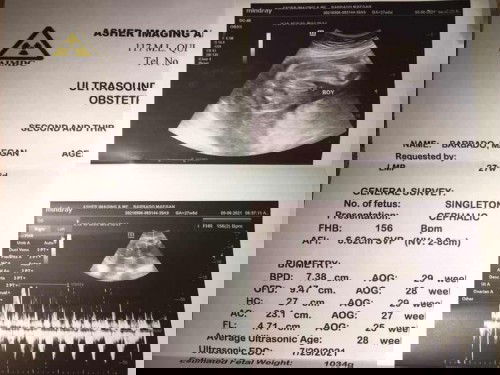 BABY BOY 😇💕👶🏻