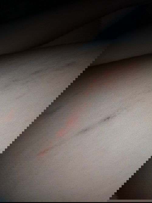 มีใครเคยเป็นไหมค่ะ