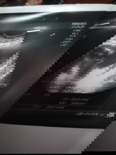 23สัปดาห์