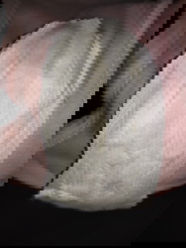 Whitish yellow discharge