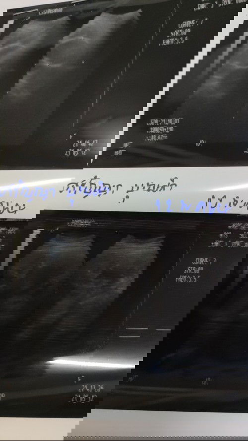 แม่ๆดูออกไหมค่ะว่าเป็นผู้หญิงหรือผู้ชาย