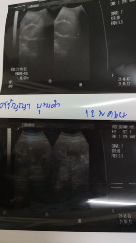 แม่ๆดูออกไหมค่ะว่าเป็นผู้หญิงหรือผู้ชาย