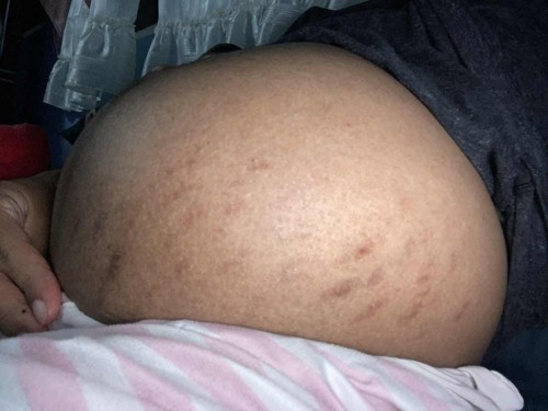 ทีมมิถุนายน กำหนดคลอด25