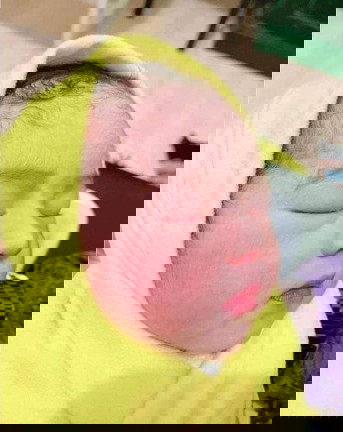 ยิ่งกว่าคำว่ารักก็คือเด็กตัวน้อยๆที่กำลังลืมตาดูโลกแม่รักหนูที่สุดนะแม่จะเข้มแข็งแล้วก็จะสู้เพื่อหนู