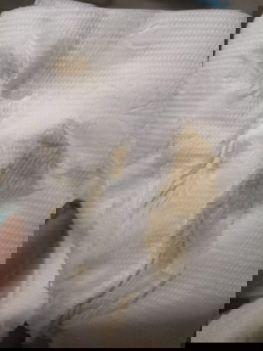 มีน้ำขุ่นออกมาหลังจากฉี่เสร็จสีแบบในรูปเลยค่ะ อยากทราบว่าอันตรายมั้ย แล้วมันคืออะไรเหรอคะ