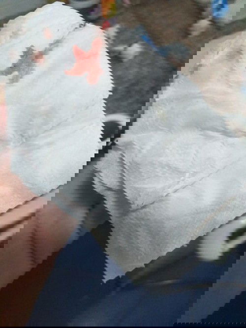 38+5 มีเลือดออกแบบนี้ ปวดท้องแบบปวดๆหายๆ ควรไปหาหมอมั้ยคะ