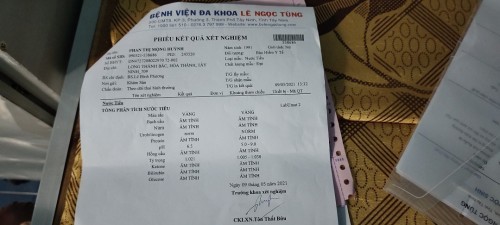 E 16 tuần rồi mà em bị phù chân đau nhức cả người tê tay đau tay nữa mom nào cho e xin ý kiến với