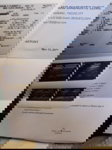 pa post lang poπ natutuwa lang po ako kasi ayaw pa pakita ni baby kung ano gender nia ππ