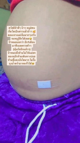 ลูกแฝด เจาะน้ำคร่ำ